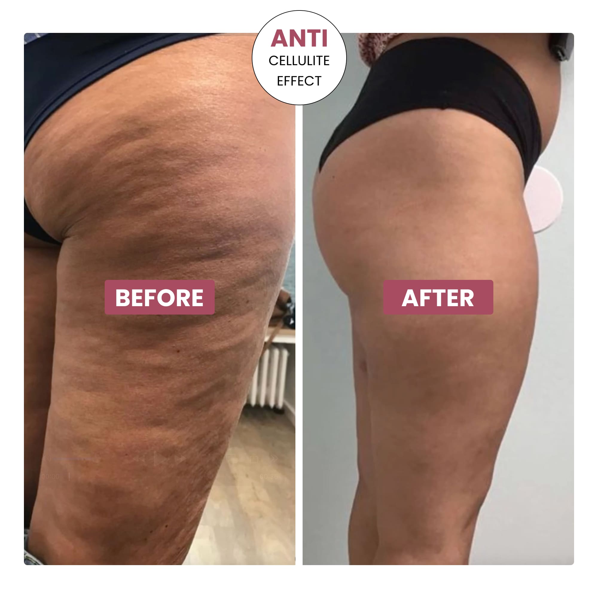 SmoothForm™ 3D Sculpting Leggings